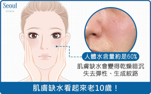 水光針-肌膚缺水看起來老10歲-首爾醫美