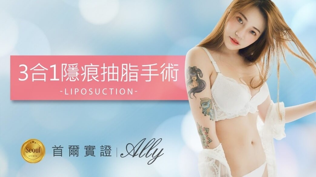抽脂手術_網紅實證_首爾醫美