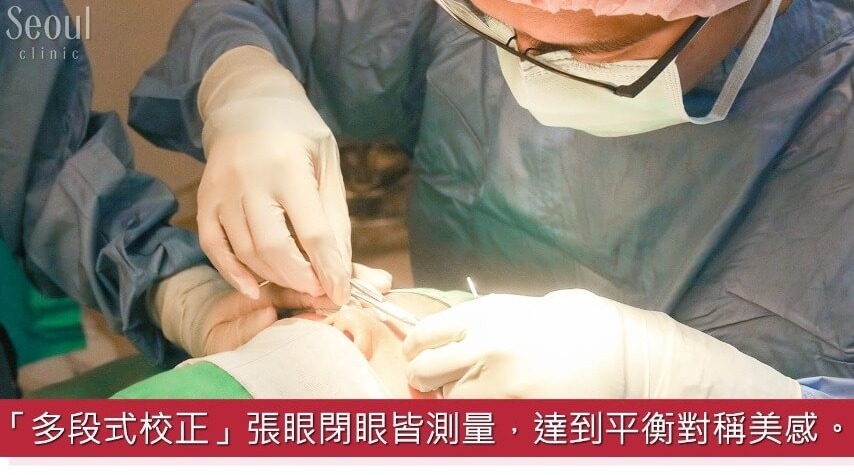 雙眼皮_治療過程_首爾醫美