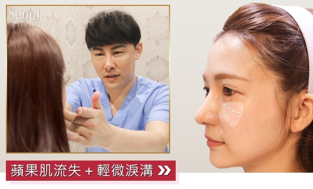 玻尿酸_諮詢過程_首爾醫美