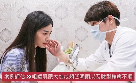 肉毒瘦小臉_諮詢過程_首爾醫美