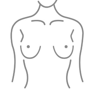 隆乳手術_胸距寬_首爾醫美