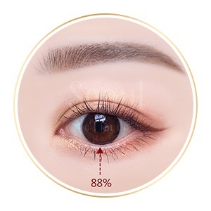 雙眼皮手術_眼珠露出_首爾醫美