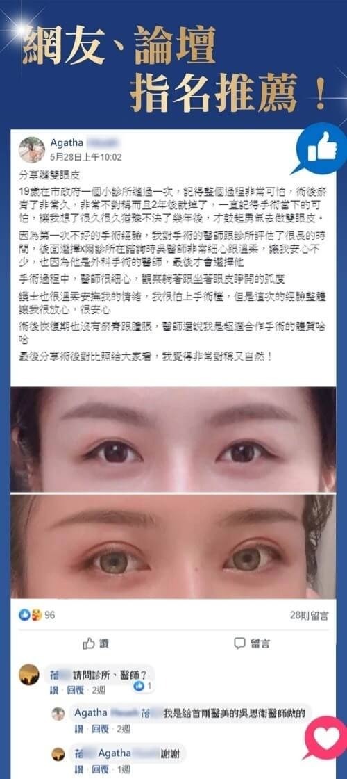 首爾醫美雙眼皮手術_口碑推薦