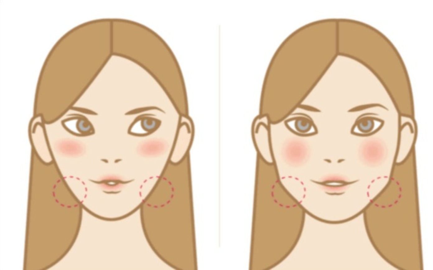 首爾醫美瘦小臉_咀嚼肌示意圖