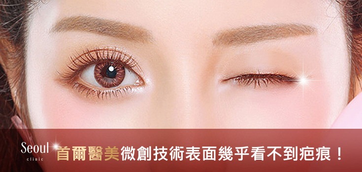 開眼頭眼尾_微創疤痕_首爾醫美