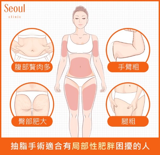 抽脂手術-適應對象-首爾醫美