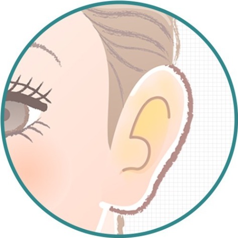 狐臭治療改善_症狀3_首爾醫美