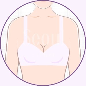 守則1_Q2_希望的胸部觸感_首爾醫美