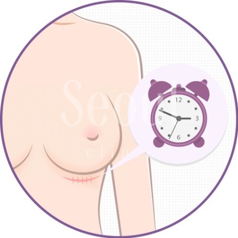 守則2_Q3_在意疤痕恢復期較長嗎