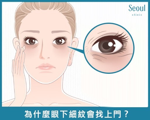 眼周電波_眼下細紋_首爾醫美