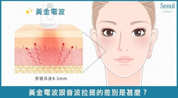 眼周電波_DCARD問題3_首爾醫美