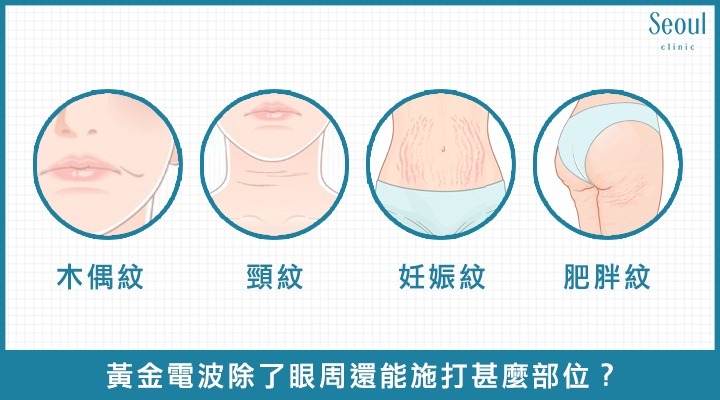 眼周電波_DCARD問題4_首爾醫美