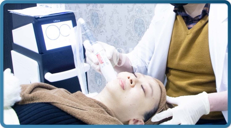 音波拉提-施作過程-首爾醫美